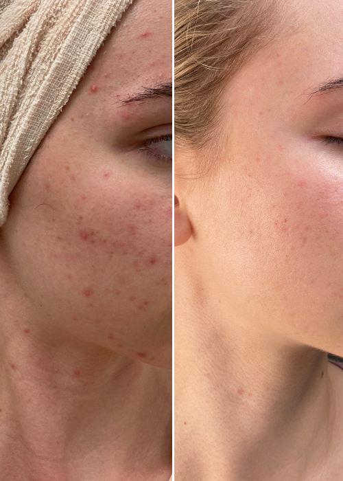 Dodaj nagłówek (500×700 px)