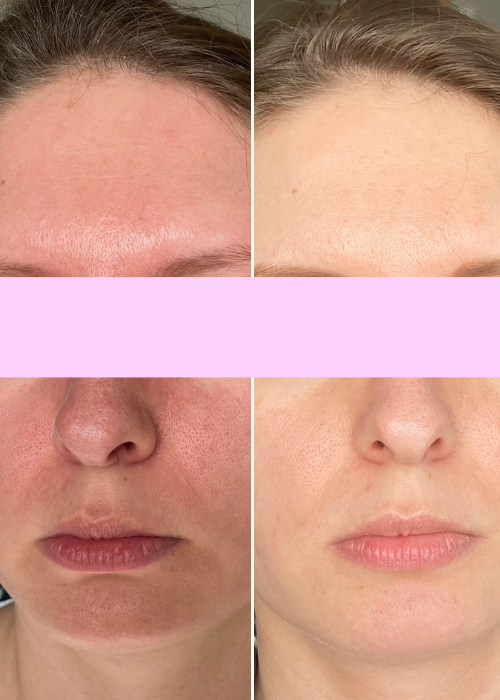 Dodaj nagłówek (500×700 px)-3